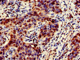 Immunofluorescent analysis of Hela cells using CAC14721 at dilution of 1:100 and Alexa Fluor 488-congugated AffiniPure Goat Anti-Rabbit IgG(H+L)