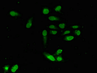 EMD Polyclonal Antibody - image 5