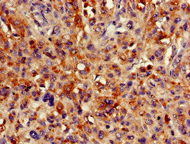 Immunofluorescent analysis of HepG2 cells using CAC14727 at dilution of 1:100 and Alexa Fluor 488-congugated AffiniPure Goat Anti-Rabbit IgG(H+L)