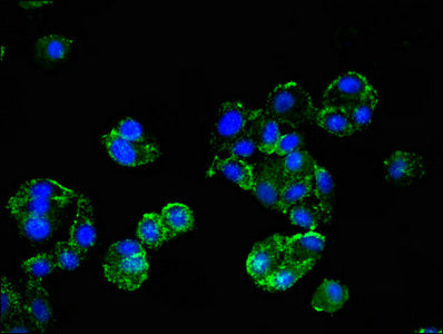 HMBS Polyclonal Antibody - image 5