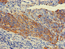 Immunofluorescent analysis of HepG2 cells using CAC14736 at dilution of 1:100 and Alexa Fluor 488-congugated AffiniPure Goat Anti-Rabbit IgG(H+L)