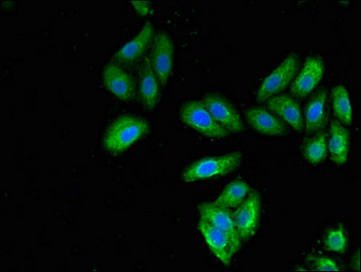 Western Blot, Positive WB detected in: Hela whole cell lysate, All lanes: KRT7 antibody at 3ug/ml, Secondary, Goat polyclonal to rabbit IgG at 1/50000 dilution, Predicted band size: 52 kDa, Observed band size: 52 kDa