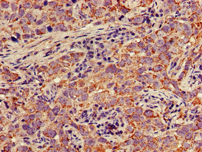 MAP2K1 Polyclonal Antibody - image 4