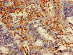 Immunofluorescent analysis of Hela cells using CAC14740 at dilution of 1:100 and Alexa Fluor 488-congugated AffiniPure Goat Anti-Rabbit IgG(H+L)