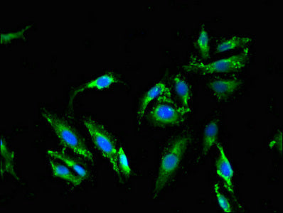Western Blot, Positive WB detected in: Hela whole cell lysate, Mouse kidney tissue, Mouse liver tissue, All lanes: MLPH antibody at 3ug/ml, Secondary, Goat polyclonal to rabbit IgG at 1/50000 dilution, Predicted band size: 66, 63, 53, 61, 51 kDa, Observed band size: 66 kDa