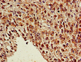 NR5A2 Polyclonal Antibody - image 4
