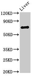 IHC image of CAC14752 diluted at 1:300 and staining in paraffin-embedded human brain tissue performed on a Leica BondTM system. After dewaxing and hydration, antigen retrieval was mediated by high pressure in a citrate buffer (pH 6.0). Section was blocked with 10% normal goat serum 30min at RT. Then primary antibody (1% BSA) was incubated at 4°C overnight. The primary is detected by a biotinylated secondary antibody and visualized using an HRP conjugated SP system.