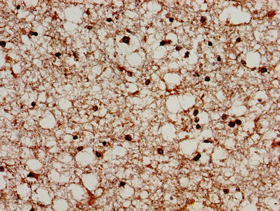 IHC image of CAC14752 diluted at 1:300 and staining in paraffin-embedded human kidney tissue performed on a Leica BondTM system. After dewaxing and hydration, antigen retrieval was mediated by high pressure in a citrate buffer (pH 6.0). Section was blocked with 10% normal goat serum 30min at RT. Then primary antibody (1% BSA) was incubated at 4°C overnight. The primary is detected by a biotinylated secondary antibody and visualized using an HRP conjugated SP system.