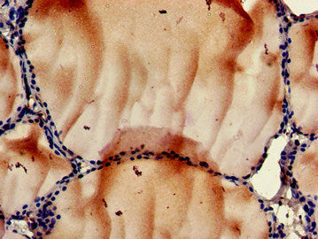 Immunohistochemistry of paraffin-embedded human placenta tissue using CAC14758 at dilution of 1:100