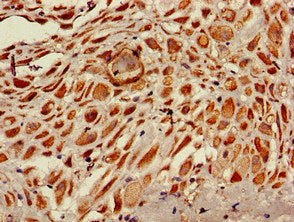 Immunofluorescent analysis of MCF-7 cells using CAC14758 at dilution of 1:100 and Alexa Fluor 488-congugated AffiniPure Goat Anti-Rabbit IgG(H+L)