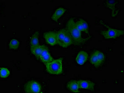 RPS6KA5 Polyclonal Antibody - image 5