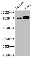 Immunohistochemistry of paraffin-embedded human spleen tissue using CAC14765 at dilution of 1:100