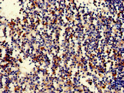 Immunofluorescent analysis of HepG2 cells using CAC14765 at dilution of 1:100 and Alexa Fluor 488-congugated AffiniPure Goat Anti-Rabbit IgG(H+L)