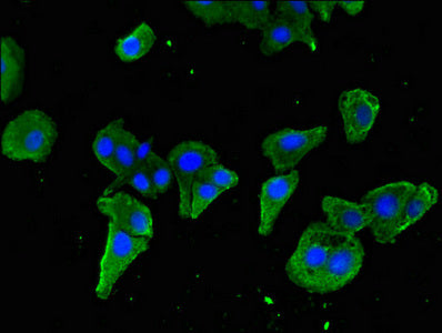 Immunohistochemistry of paraffin-embedded human testis tissue using CAC14765 at dilution of 1: 100