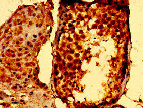 STAT5B Polyclonal Antibody - image 5