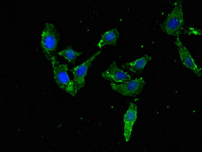 Western Blot, Positive WB detected in: Rat lung tissue, All lanes: TFEB antibody at 3ug/ml, Secondary, Goat polyclonal to rabbit IgG at 1/50000 dilution, Predicted band size: 53, 44 kDa, Observed band size: 70 kDa