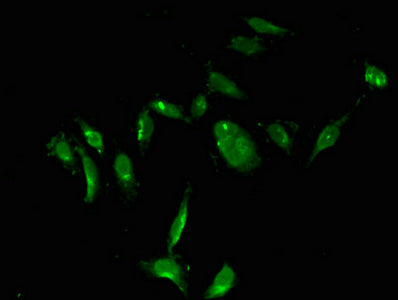Immunoprecipitating TYMS in Hela whole cell lysate, Lane 1: Rabbit control IgG instead of CAC14768 in Hela whole cell lysate. For western blotting, a HRP-conjugated Protein G antibody was used as the secondary antibody (1/2000), Lane 2: CAC14768 (8ug) + Hela whole cell lysate (500ug), Lane 3: Hela whole cell lysate (10ug)