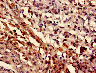 MEF2D Polyclonal Antibody - image 4