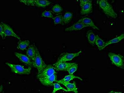 CAMK1 Polyclonal Antibody - image 3