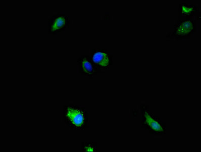 MAP2K5 Polyclonal Antibody - image 3