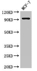GRIK4 Polyclonal Antibody - image 2