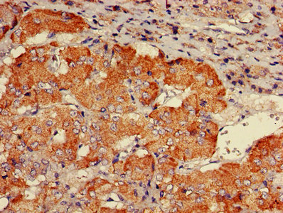 Immunofluorescent analysis of Hela cells using CAC14794 at dilution of 1:100 and Alexa Fluor 488-congugated AffiniPure Goat Anti-Rabbit IgG(H+L)