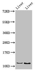 Immunohistochemistry of paraffin-embedded human kidney tissue using CAC14796 at dilution of 1:100