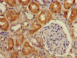 Immunofluorescent analysis of PC-3 cells using CAC14796 at dilution of 1:100 and Alexa Fluor 488-congugated AffiniPure Goat Anti-Rabbit IgG(H+L)