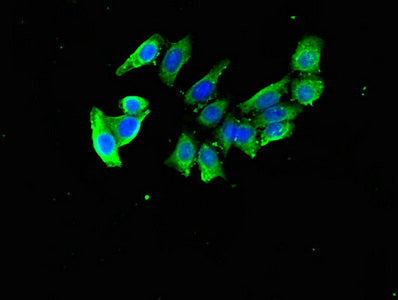 DDA1 Polyclonal Antibody - image 4