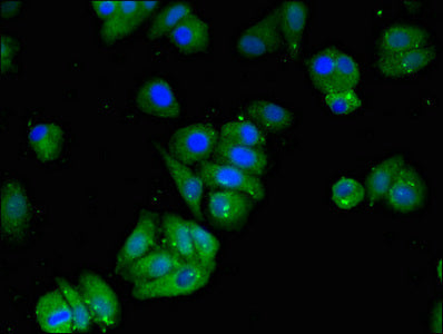 Western Blot, Positive WB detected in: Rat heart tissue, All lanes: MAT2B antibody at 4ug/ml, Secondary, Goat polyclonal to rabbit IgG at 1/50000 dilution, Predicted band size: 38, 37, 29, 35, 10 kDa, Observed band size: 38 kDa