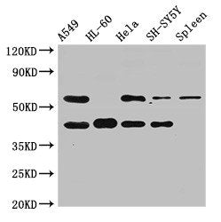 Immunohistochemistry of paraffin-embedded human gastric cancer using CAC14804 at dilution of 1:100