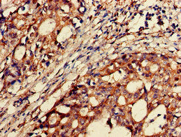 Immunofluorescent analysis of A549 cells using CAC14804 at dilution of 1:100 and Alexa Fluor 488-congugated AffiniPure Goat Anti-Rabbit IgG(H+L)