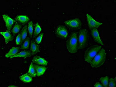 BACE2 Polyclonal Antibody - image 4