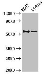 Immunohistochemistry of paraffin-embedded human lung tissue using CAC14811 at dilution of 1:100