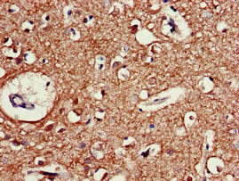 Immunofluorescent analysis of A549 cells using CAC14826 at dilution of 1:100 and Alexa Fluor 488-congugated AffiniPure Goat Anti-Rabbit IgG(H+L)