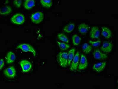 CHRM5 Polyclonal Antibody - image 4