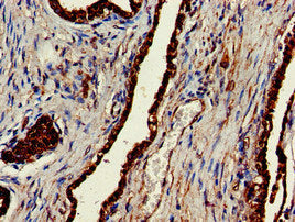 Immunohistochemistry of paraffin-embedded human brain tissue using CAC14827 at dilution of 1:100