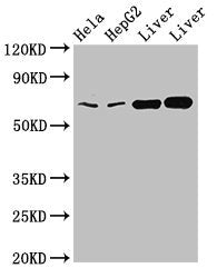 CLINT1 Polyclonal Antibody - image 4