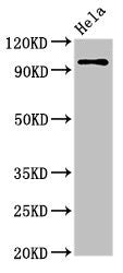Immunohistochemistry of paraffin-embedded human brain tissue using CAC14828 at dilution of 1:100