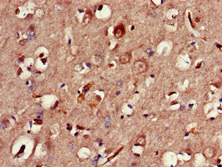 Immunofluorescent analysis of Hela cells using CAC14828 at dilution of 1:100 and Alexa Fluor 488-congugated AffiniPure Goat Anti-Rabbit IgG(H+L)