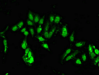 CLOCK Polyclonal Antibody - image 4