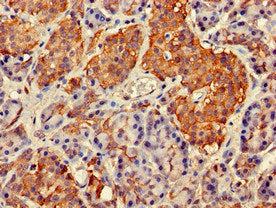 Immunofluorescent analysis of Hela cells using CAC14837 at dilution of 1:100 and Alexa Fluor 488-congugated AffiniPure Goat Anti-Rabbit IgG(H+L)