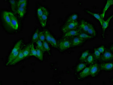 GIT1 Polyclonal Antibody - image 5