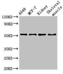 Immunofluorescent analysis of Hela cells using CAC14858 at dilution of 1:100 and Alexa Fluor 488-congugated AffiniPure Goat Anti-Rabbit IgG(H+L)