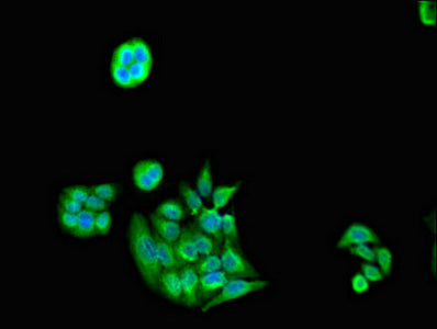 PSMC5 Polyclonal Antibody - image 3