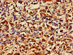 Immunofluorescent analysis of Hela cells using CAC14878 at dilution of 1:100 and Alexa Fluor 488-congugated AffiniPure Goat Anti-Rabbit IgG(H+L)