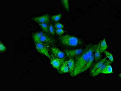 Western Blot, Positive WB detected in: Rat heart tissue, Mouse brain tissue, Mouse liver tissue, Mouse kidney tissue, All lanes: RUNX3 antibody at 3ug/ml, Secondary, Goat polyclonal to rabbit IgG at 1/50000 dilution, Predicted band size: 45, 46 kDa, Observed band size: 45 kDa
