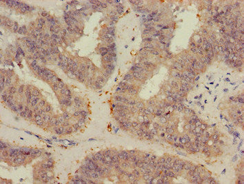 VEGFB Polyclonal Antibody - image 4