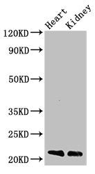 Immunohistochemistry of paraffin-embedded human liver cancer using CAC14888 at dilution of 1:100