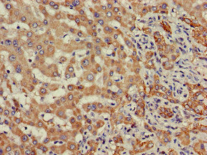 Immunohistochemistry of paraffin-embedded human brain tissue using CAC14888 at dilution of 1:100